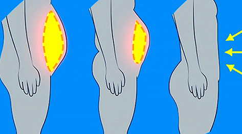 Only 1 Cup Of This Before Sleep And 4,5 Kg Will Vanish In 1 Week! Only 1 Cup Of This Before Sleep And 4,5 Kg Will Vanish In 1 Week!